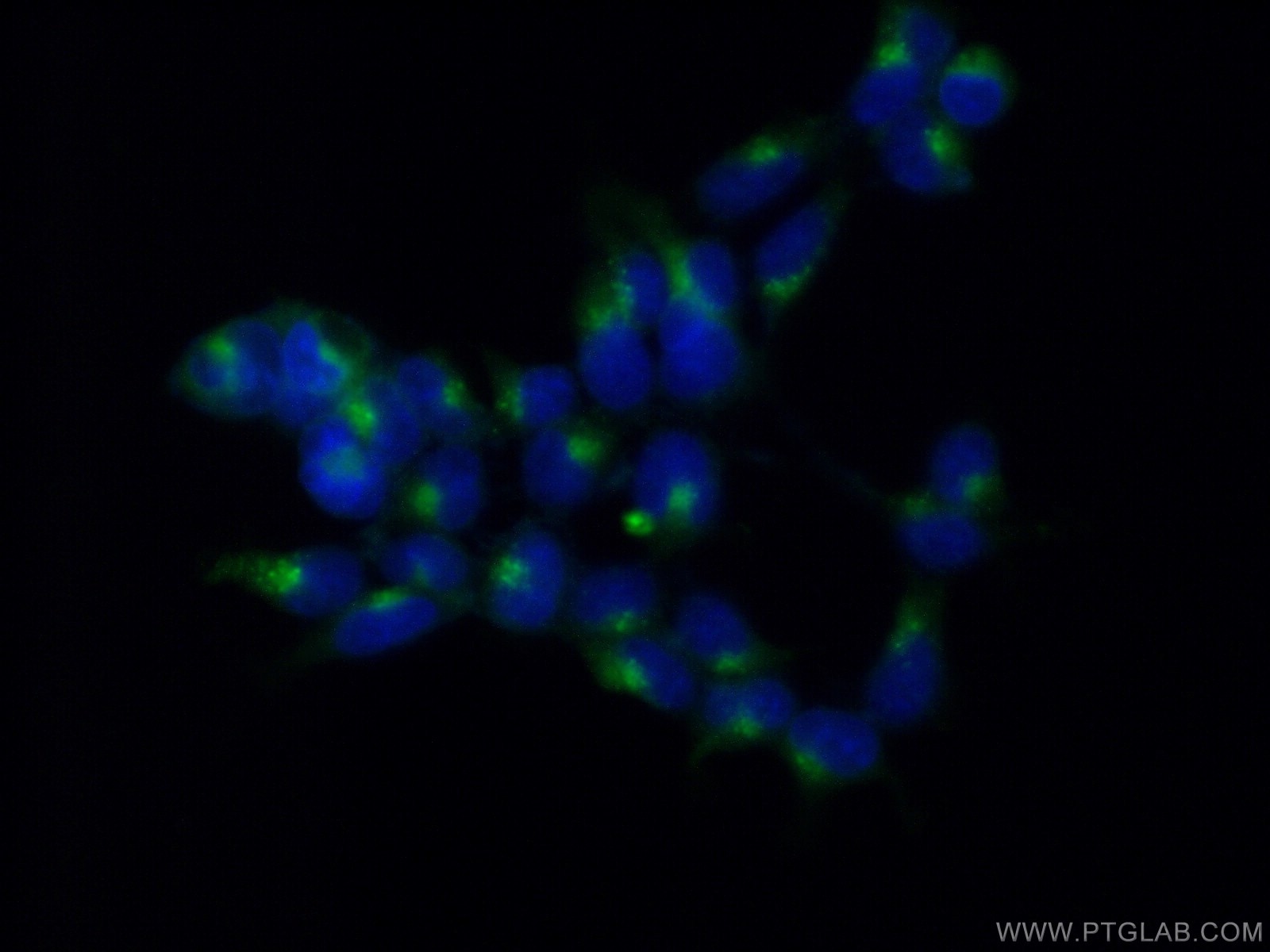 Immunofluorescence (IF) / fluorescent staining of HEK-293 cells using PSAP Polyclonal antibody (10801-1-AP)