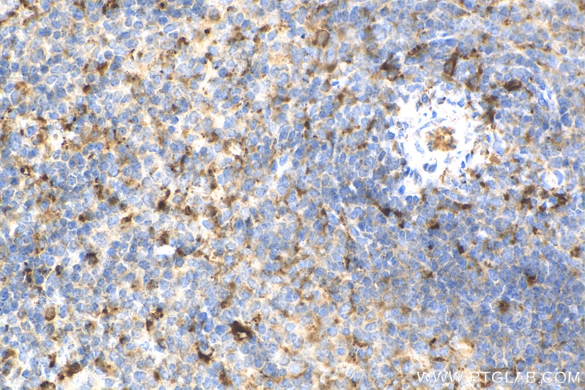 Immunohistochemistry (IHC) staining of mouse spleen tissue using PSAP Polyclonal antibody (10801-1-AP)