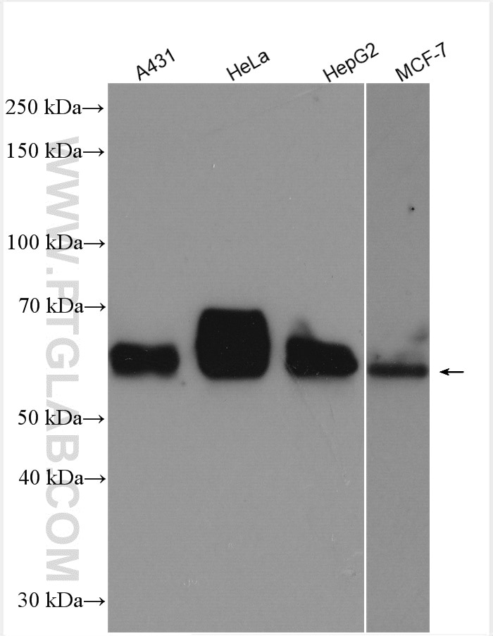 Western Blot (WB) analysis of various lysates using PSAP Polyclonal antibody (10801-1-AP)