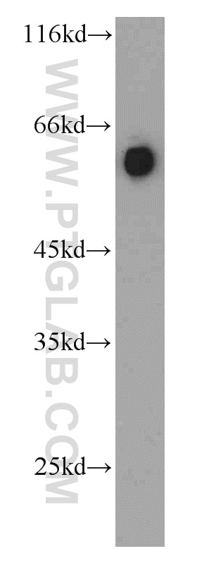 PSAP Polyclonal antibody