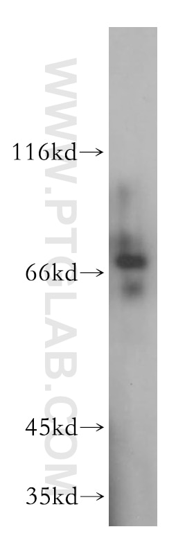 Western Blot (WB) analysis of human liver tissue using PSAP Polyclonal antibody (18396-1-AP)