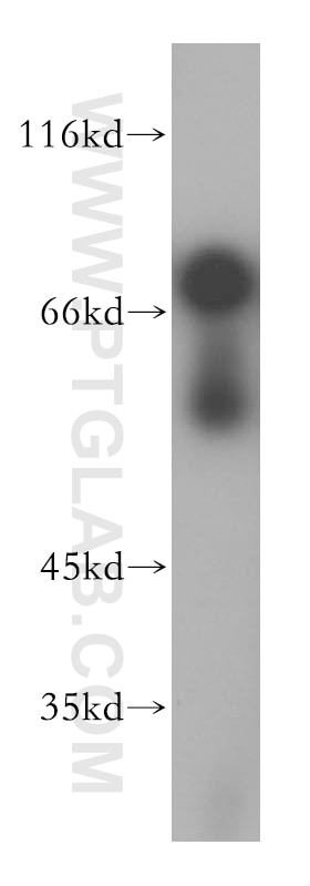 Western Blot (WB) analysis of HepG2 cells using PSAP Polyclonal antibody (18396-1-AP)