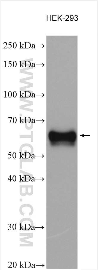 Western Blot (WB) analysis of various lysates using PSAP Polyclonal antibody (18397-1-AP)