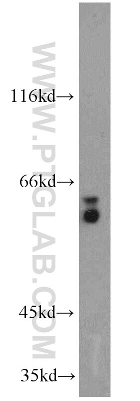 Western Blot (WB) analysis of PC-3 cells using PSAP Polyclonal antibody (18397-1-AP)