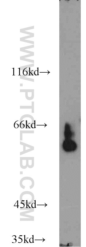 Western Blot (WB) analysis of HepG2 cells using PSAP Polyclonal antibody (18397-1-AP)