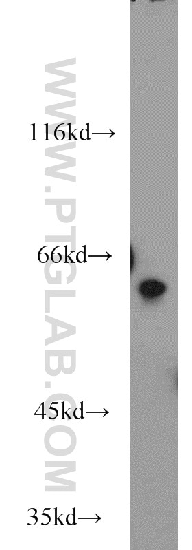 Western Blot (WB) analysis of L02 cells using PSAP Polyclonal antibody (18397-1-AP)