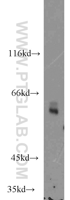 Western Blot (WB) analysis of MCF-7 cells using PSAP Polyclonal antibody (18397-1-AP)