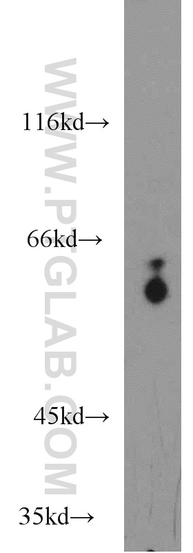 Western Blot (WB) analysis of PC-3 cells using PSAP Polyclonal antibody (18397-1-AP)