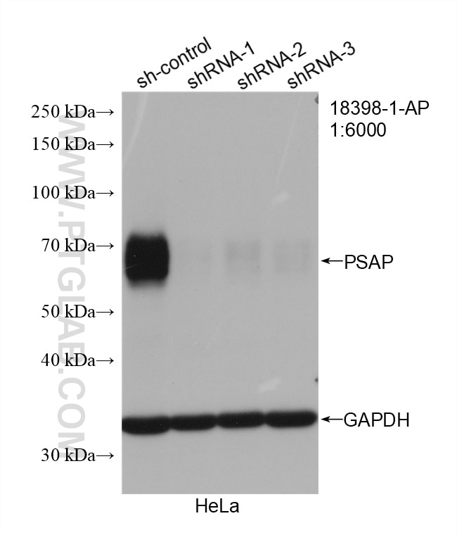 Western Blot (WB) analysis of HeLa cells using PSAP Polyclonal antibody (18398-1-AP)