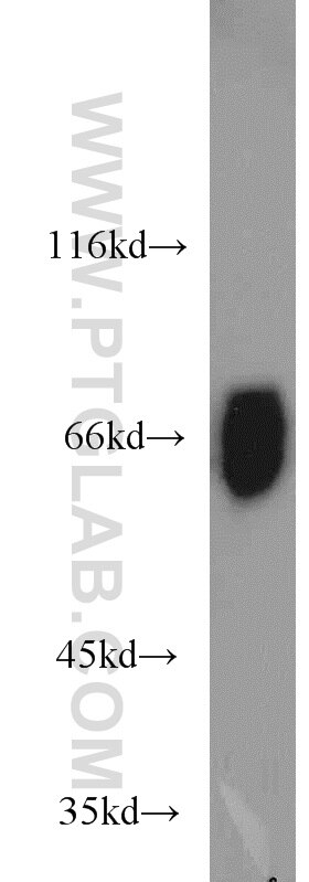 Western Blot (WB) analysis of PC-3 cells using PSAP Polyclonal antibody (18398-1-AP)