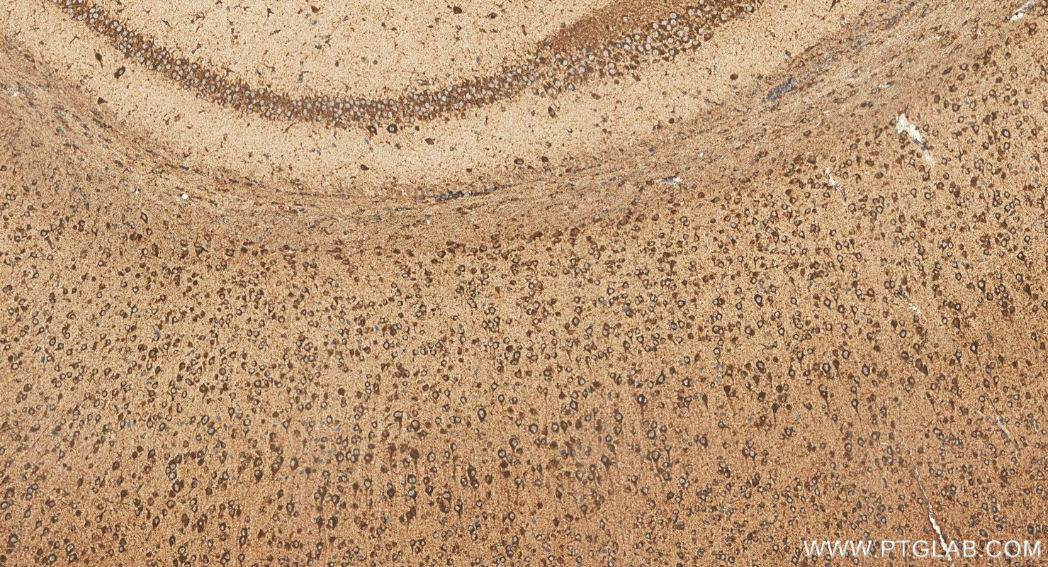 Immunohistochemistry (IHC) staining of mouse brain tissue using PSAP Polyclonal antibody (18423-1-AP)