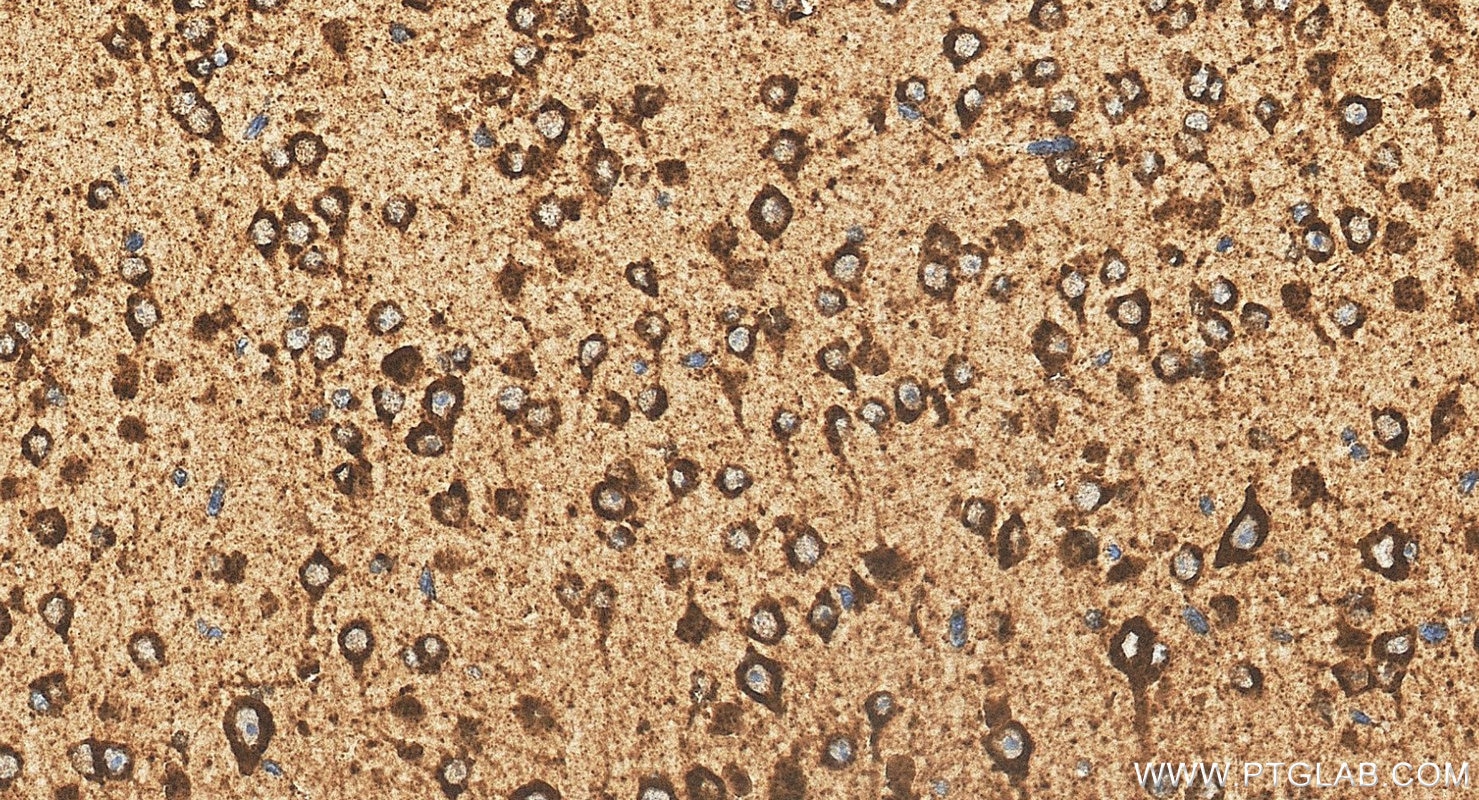 Immunohistochemistry (IHC) staining of mouse brain tissue using PSAP Polyclonal antibody (18423-1-AP)