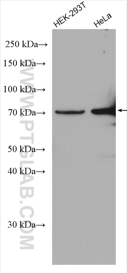 Western Blot (WB) analysis of various lysates using PSAP Polyclonal antibody (18423-1-AP)