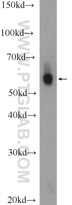 Western Blot (WB) analysis of HepG2 cells using PSAP Polyclonal antibody (18423-1-AP)