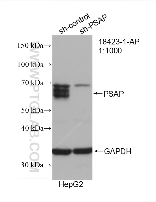Western Blot (WB) analysis of HepG2 cells using PSAP Polyclonal antibody (18423-1-AP)
