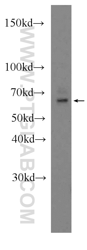 Western Blot (WB) analysis of HeLa cells using PSAP Polyclonal antibody (18423-1-AP)