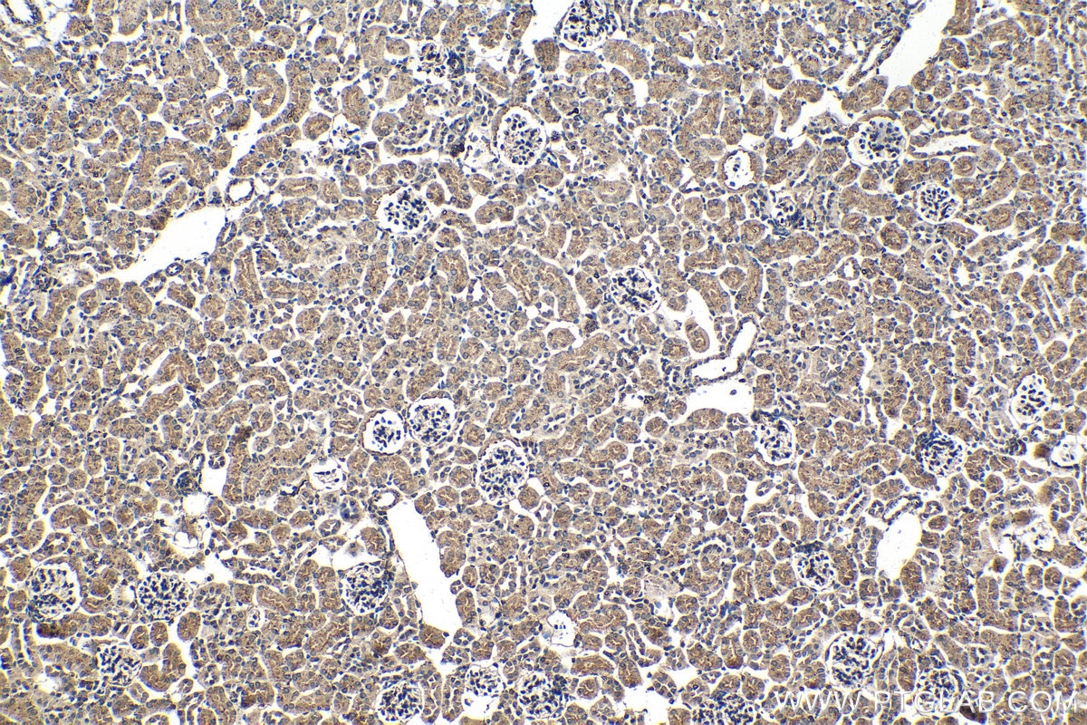 IHC staining of mouse kidney using 66473-1-Ig (same clone as 66473-1-PBS) Immunohistochemistry (IHC) staining of mouse kidney tissue using PSAP Monoclonal antibody (66473-1-Ig)
