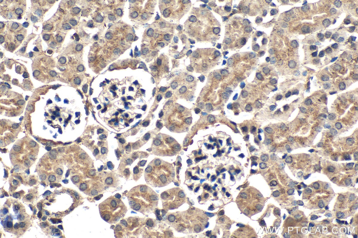 IHC staining of mouse kidney using 66473-1-Ig (same clone as 66473-1-PBS) Immunohistochemistry (IHC) staining of mouse kidney tissue using PSAP Monoclonal antibody (66473-1-Ig)