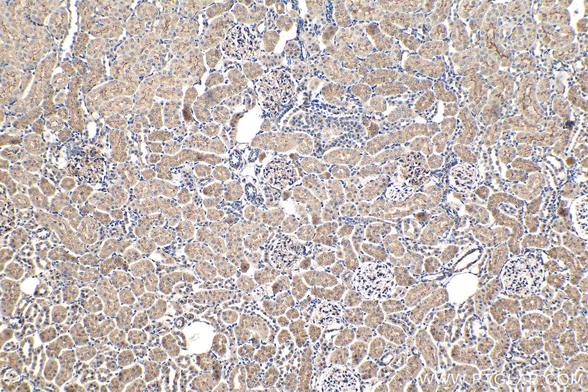 IHC staining of rat kidney using 66473-1-Ig (same clone as 66473-1-PBS) Immunohistochemistry (IHC) staining of rat kidney tissue using PSAP Monoclonal antibody (66473-1-Ig)