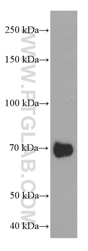 Western Blot (WB) analysis of human milk using PSAP Monoclonal antibody (66473-1-Ig)