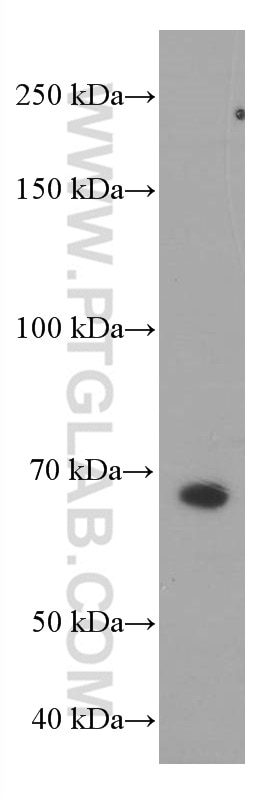 Western Blot (WB) analysis of HepG2 cells using PSAP Monoclonal antibody (66473-1-Ig)