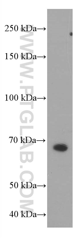 WB analysis of HepG2 using 66473-1-Ig