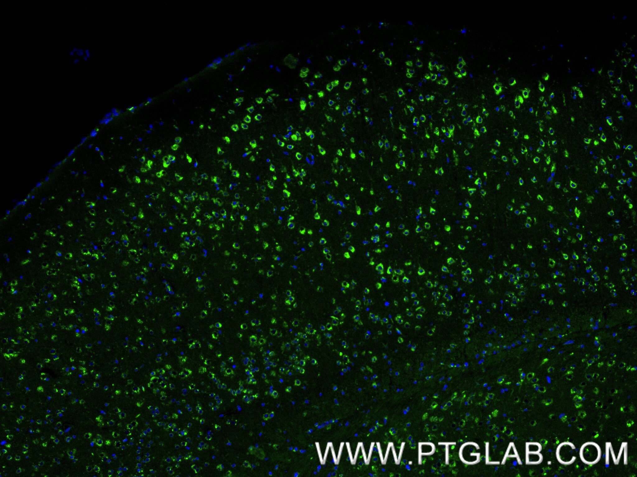 Immunofluorescence (IF) / fluorescent staining of mouse brain tissue using PSAP Recombinant monoclonal antibody (86043-2-RR)