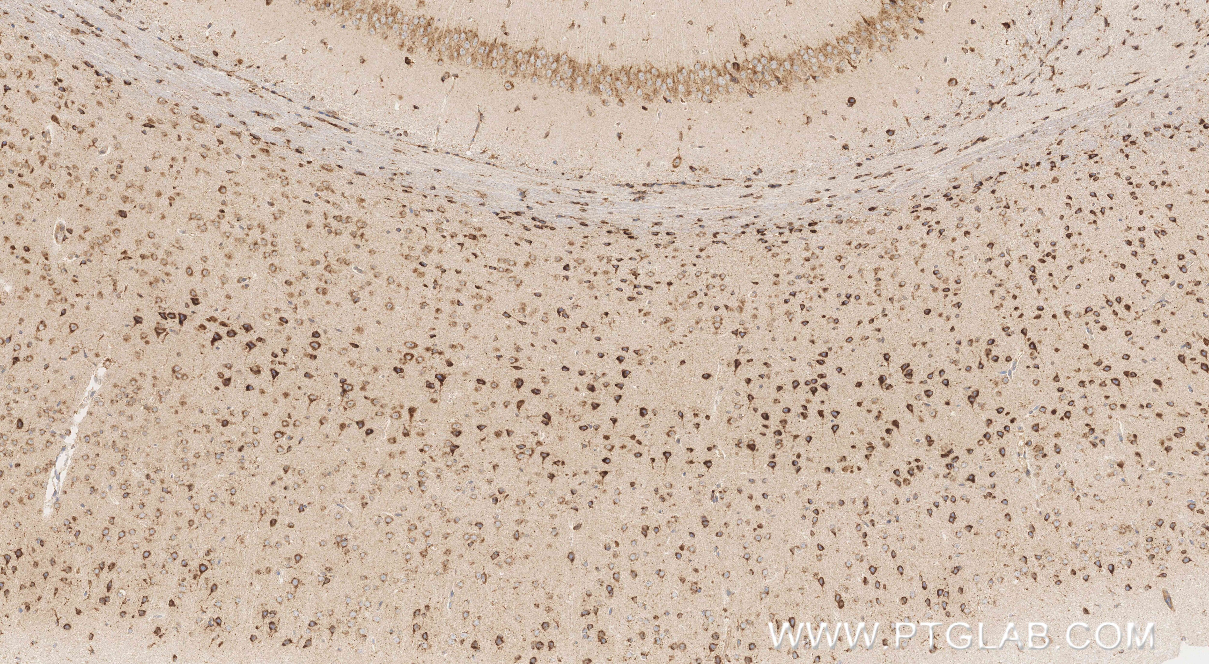 Immunohistochemistry (IHC) staining of mouse brain tissue using PSAP Recombinant monoclonal antibody (86043-2-RR)
