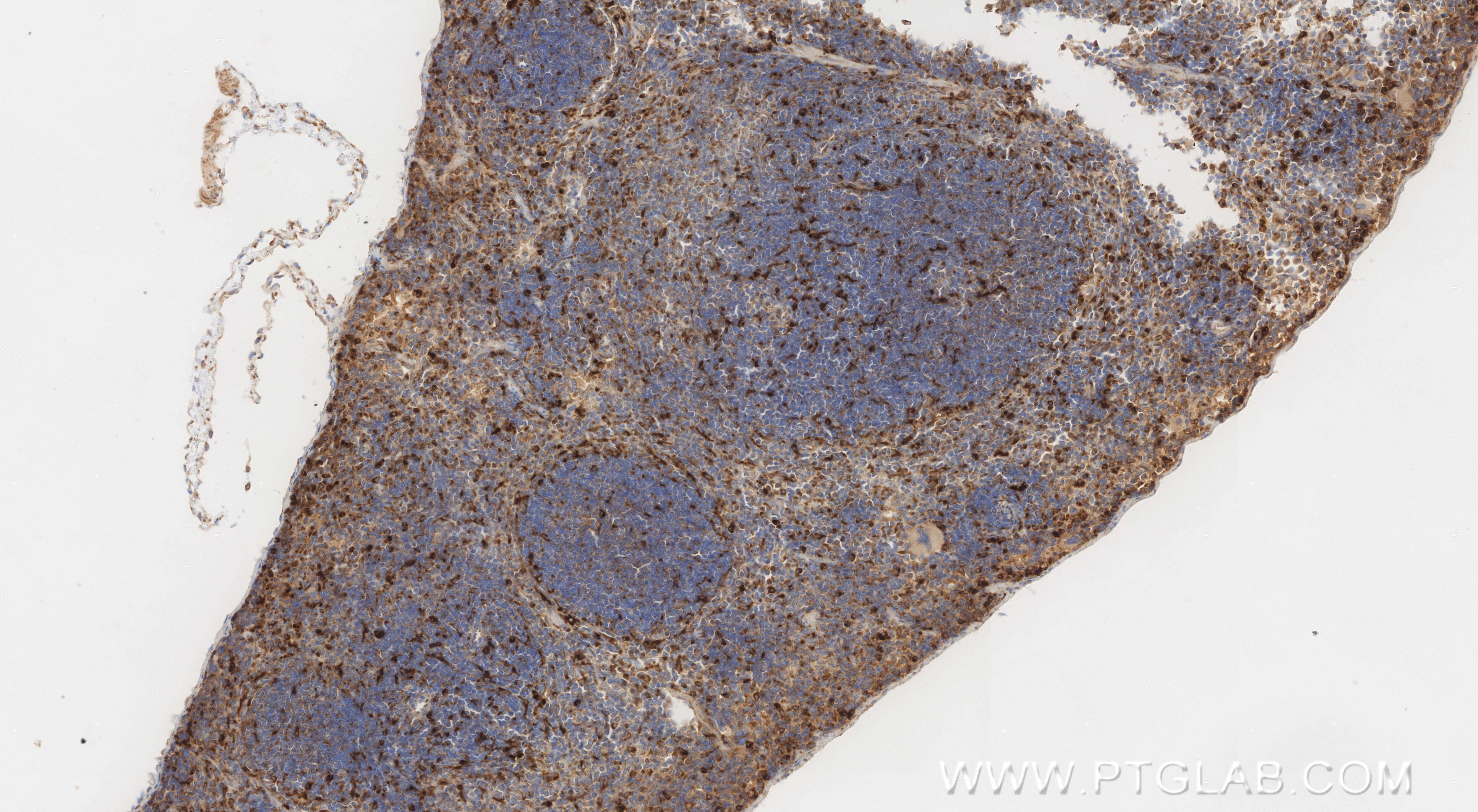 Immunohistochemistry (IHC) staining of mouse spleen tissue using PSAP Recombinant monoclonal antibody (86043-2-RR)