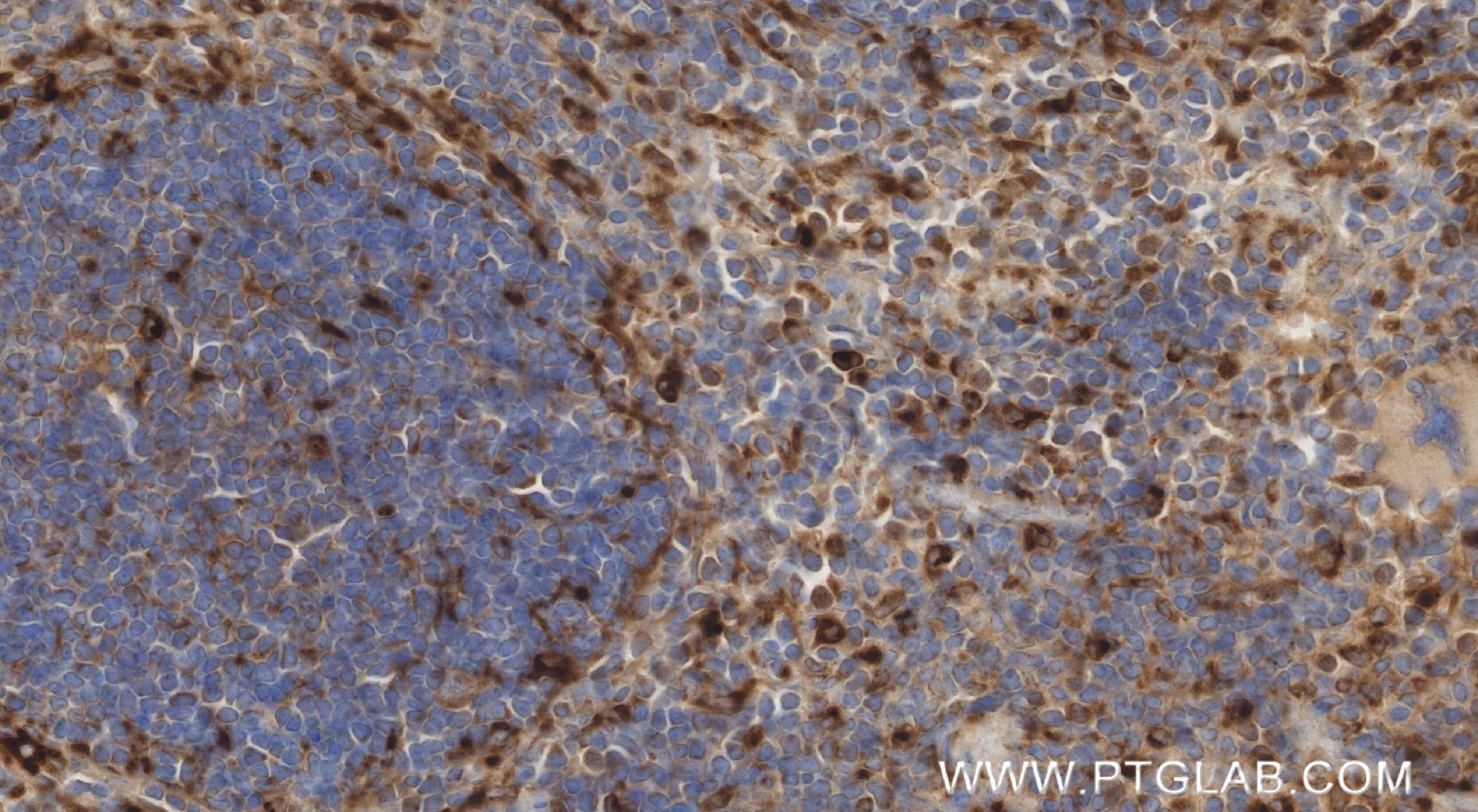Immunohistochemistry (IHC) staining of mouse spleen tissue using PSAP Recombinant monoclonal antibody (86043-2-RR)