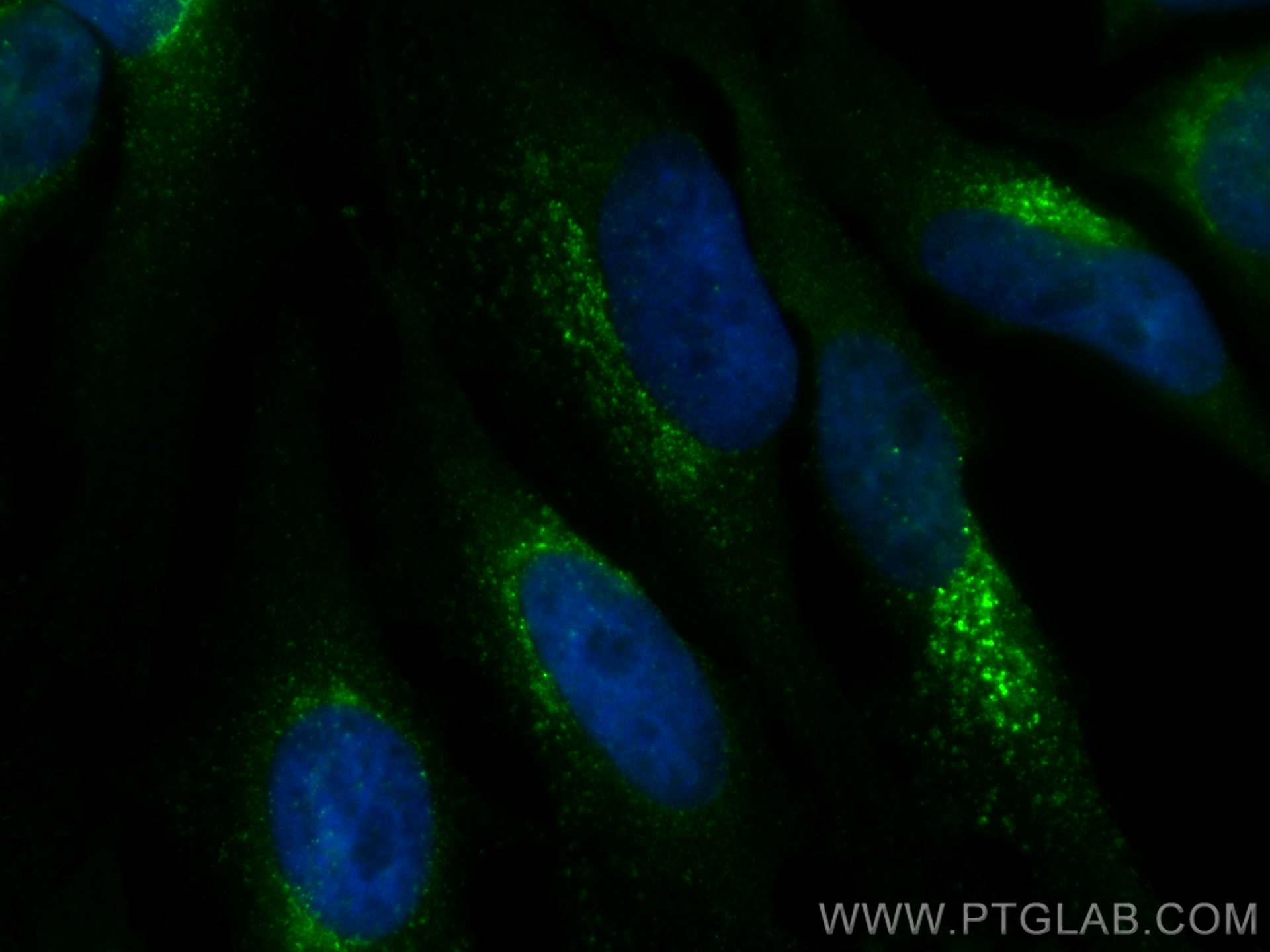 IF Staining of HeLa using CL488-10801