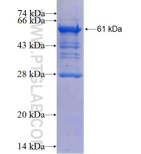 PSAP fusion protein Ag1194 SDS-PAGE