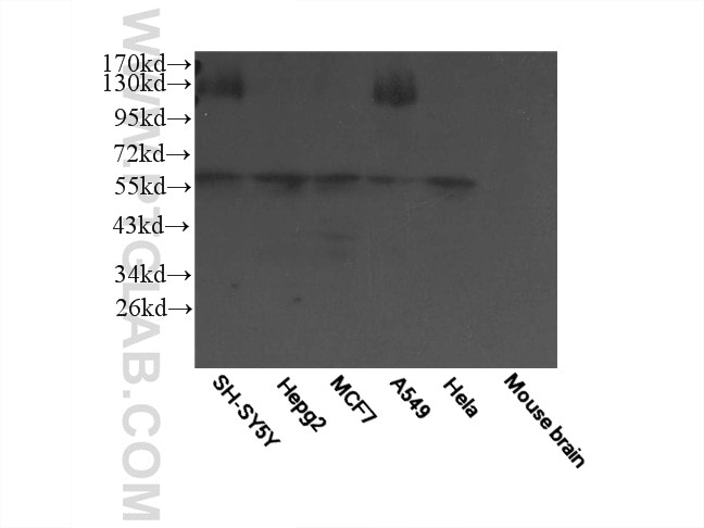 Western Blot (WB) analysis of multi-cells/tissue using PSAPL1 Polyclonal antibody (55128-1-AP)