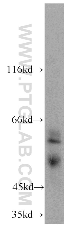 Western Blot (WB) analysis of human testis tissue using PSAPL1 Polyclonal antibody (55128-1-AP)