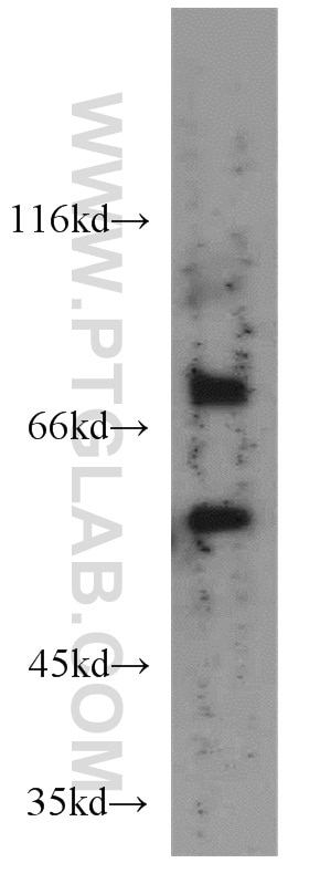 Western Blot (WB) analysis of HeLa cells using PSAPL1 Polyclonal antibody (55128-1-AP)