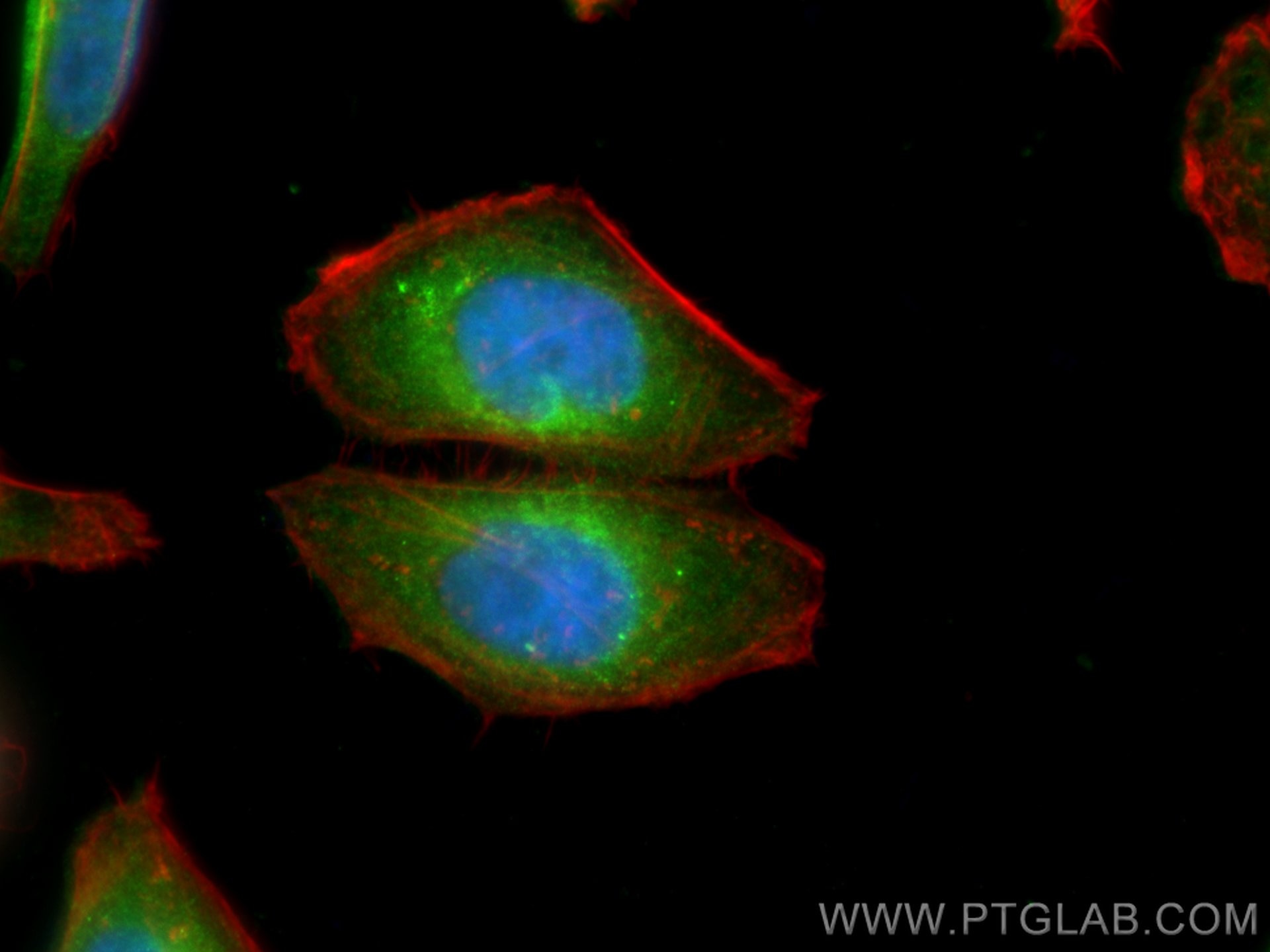 Immunofluorescence (IF) / fluorescent staining of HepG2 cells using PSAT1 Polyclonal antibody (10501-1-AP)