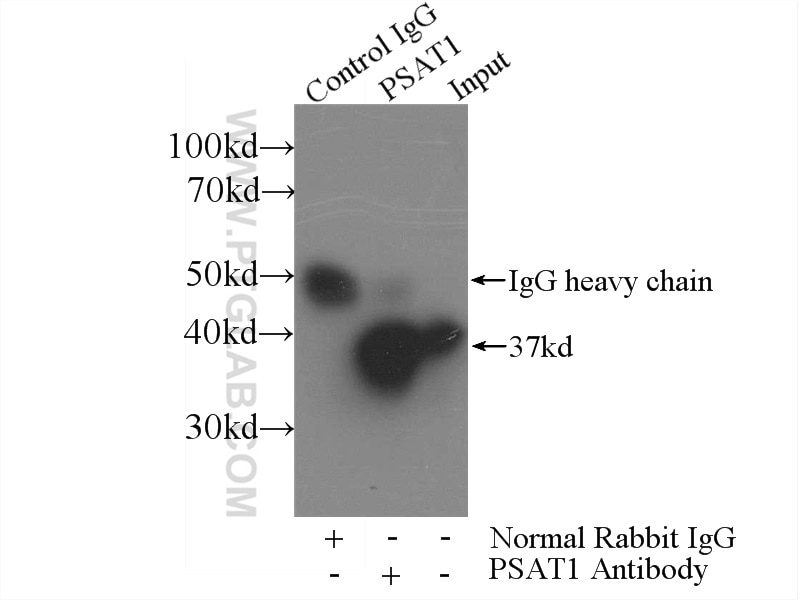 IP experiment of HeLa using 10501-1-AP