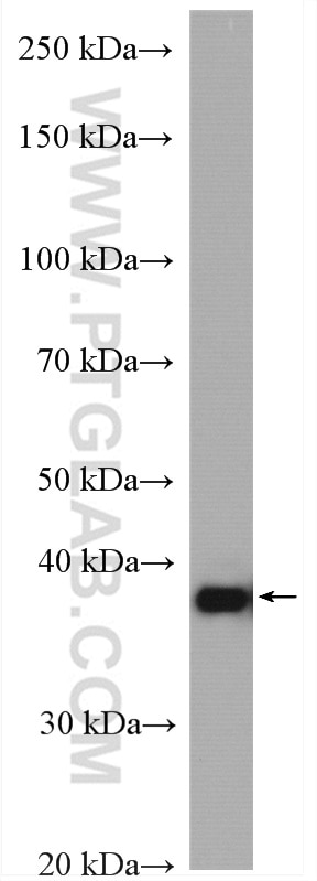 Western Blot (WB) analysis of HEK-293 cells using PSAT1 Polyclonal antibody (10501-1-AP)