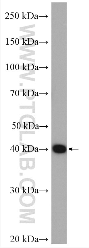 Western Blot (WB) analysis of Jurkat cells using PSAT1 Polyclonal antibody (10501-1-AP)
