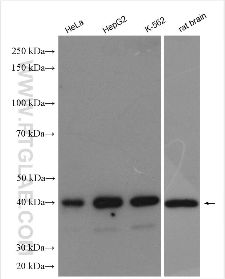 Western Blot (WB) analysis of various lysates using PSAT1 Polyclonal antibody (10501-1-AP)