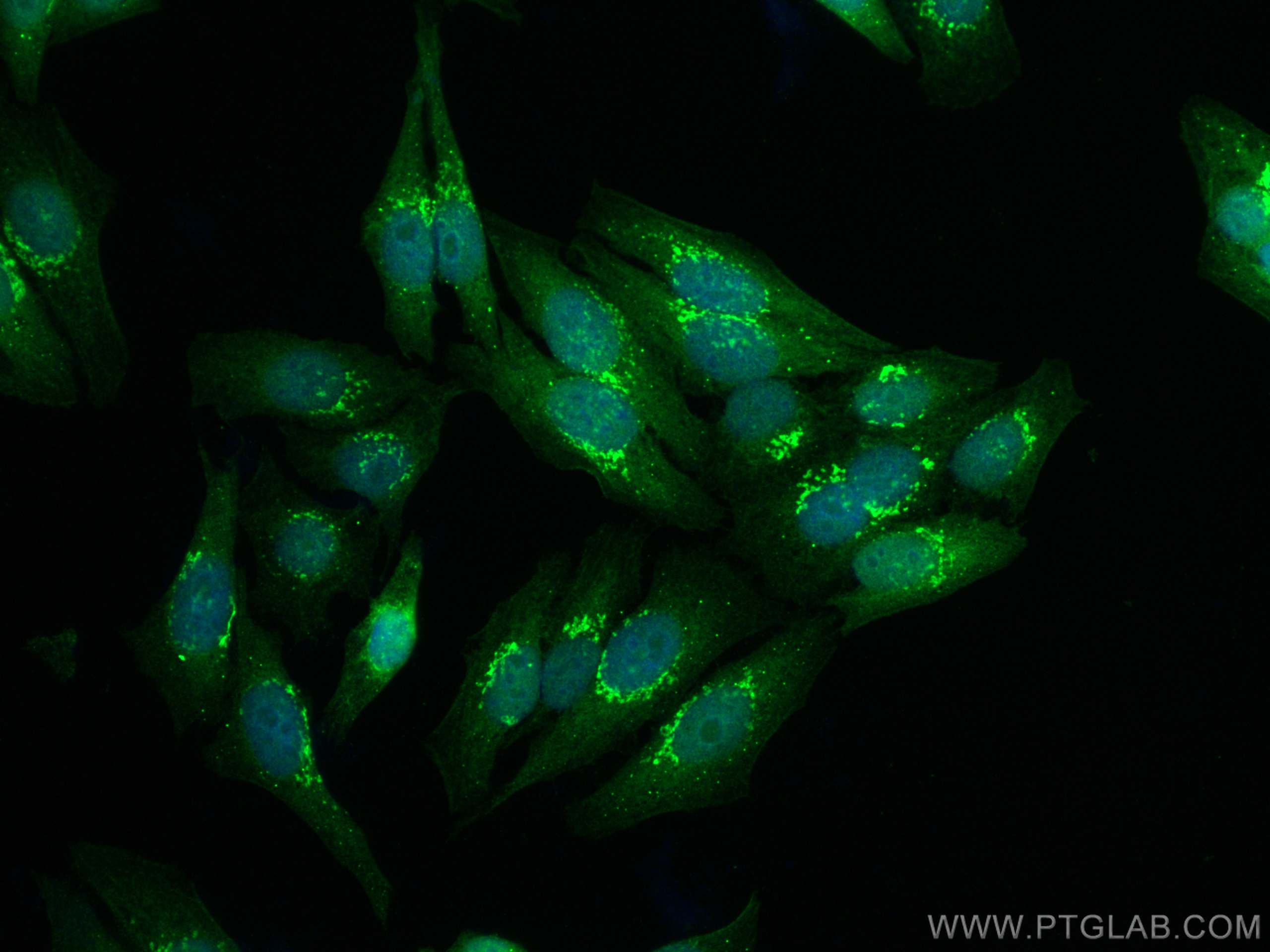 Immunofluorescence (IF) / fluorescent staining of HepG2 cells using PSAT1 Polyclonal antibody (20180-1-AP)