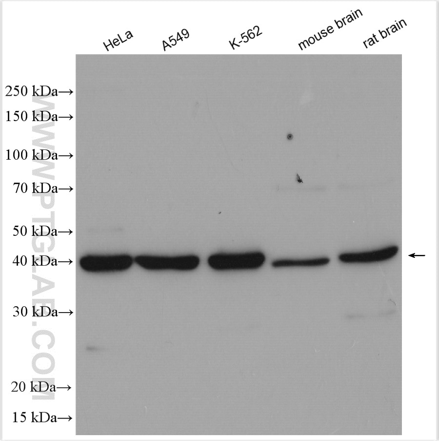 Western Blot (WB) analysis of various lysates using PSAT1 Polyclonal antibody (20180-1-AP)