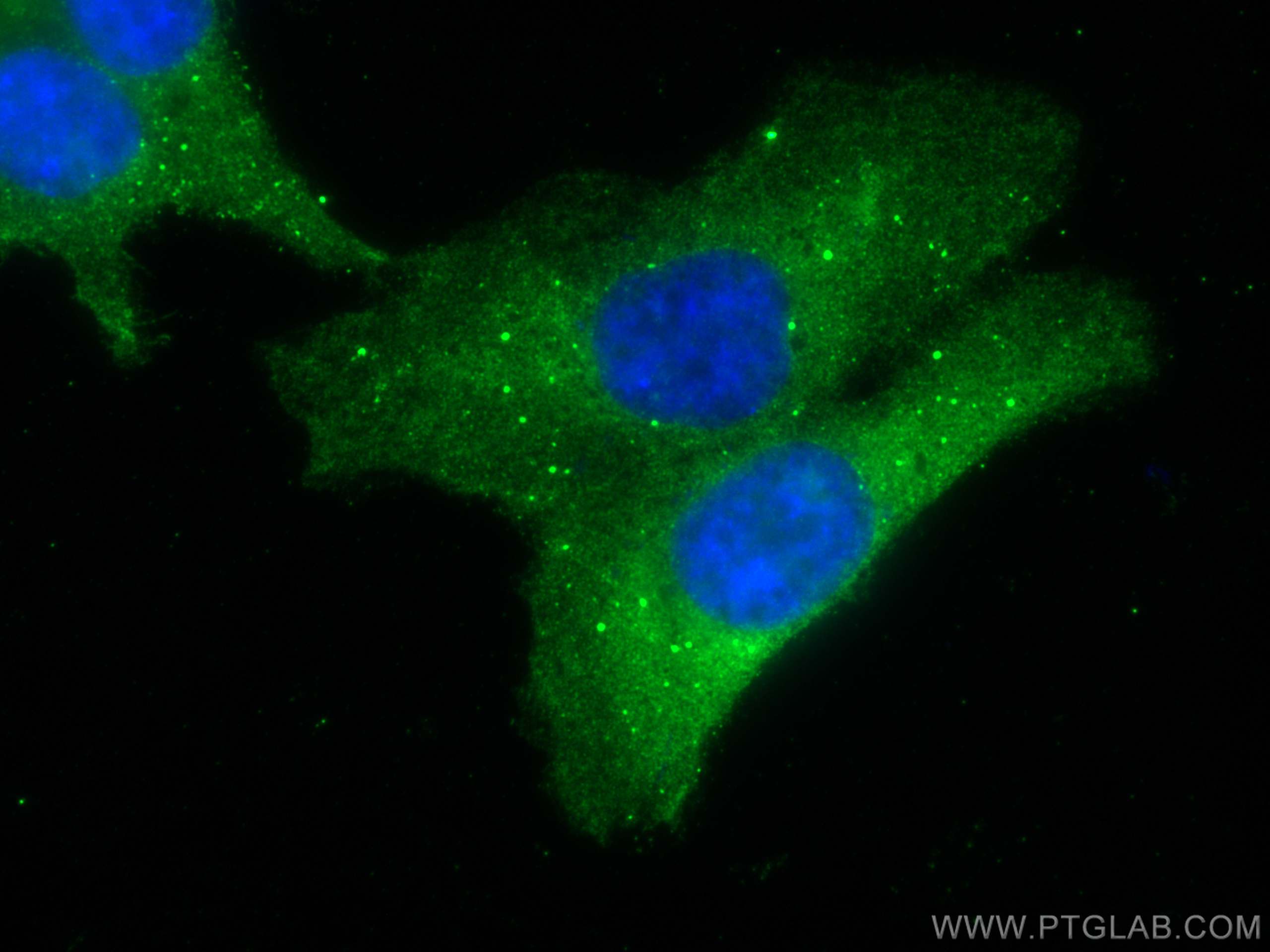 Immunofluorescence (IF) / fluorescent staining of HCT 116 cells using PSAT1 Monoclonal antibody (67619-1-Ig)