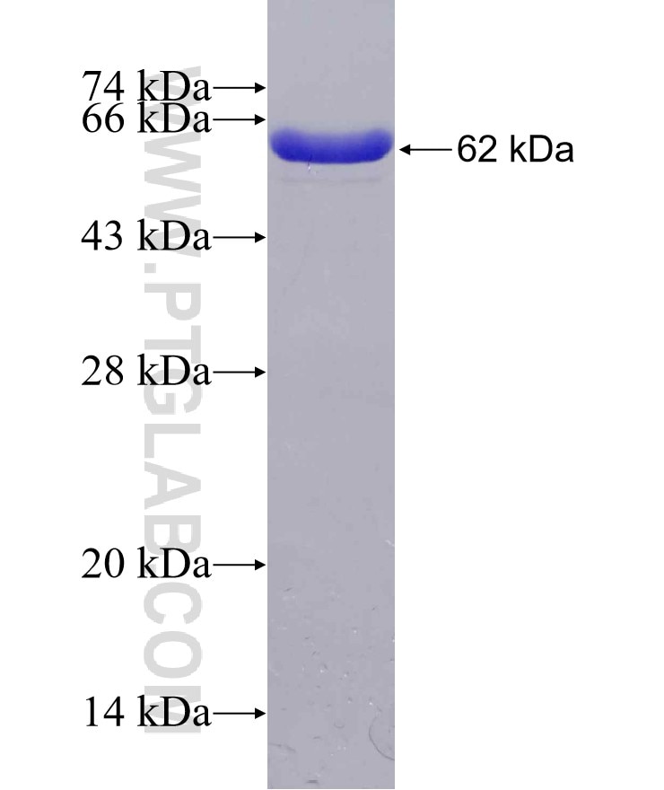 PSAT1 fusion protein Ag14044 SDS-PAGE