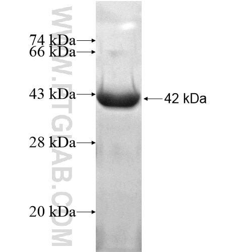 PSAT1 fusion protein Ag14076 SDS-PAGE