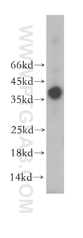 Western Blot (WB) analysis of PC-3 cells using PSCA Polyclonal antibody (17171-1-AP)