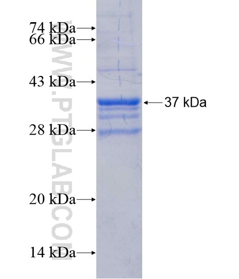 PSCA fusion protein Ag10710 SDS-PAGE