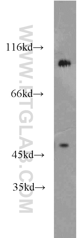 Western Blot (WB) analysis of mouse brain tissue using PSD2 Polyclonal antibody (17404-1-AP)