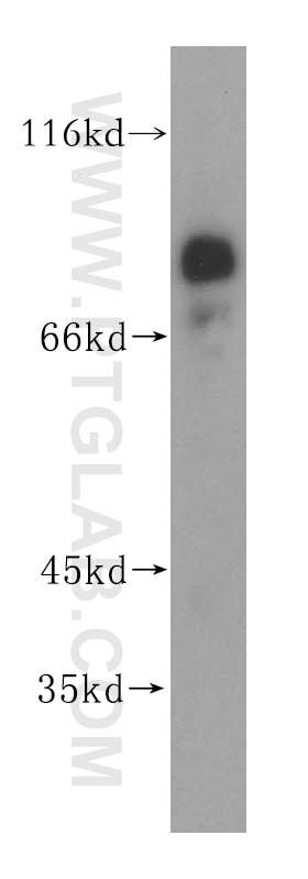 Western Blot (WB) analysis of mouse brain tissue using PSD2 Polyclonal antibody (17404-1-AP)
