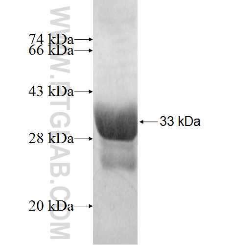 PSD3 fusion protein Ag2884 SDS-PAGE